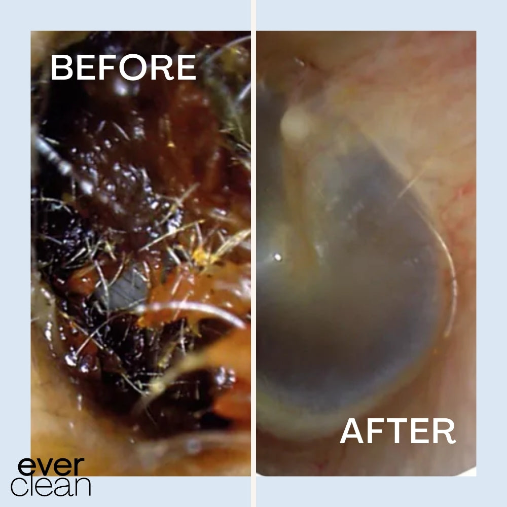 EARJET 2.0™ - Say Goodbye to Muffled Hearing Forever.